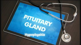 thumbnail of medium Hypophysitis